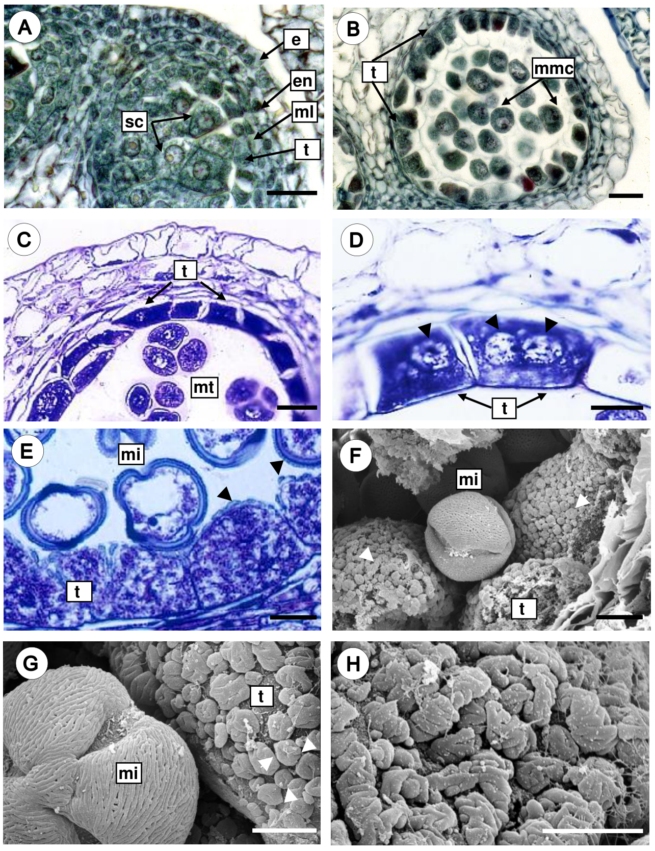 Microsporogenesis, microgametogenesis, and pollen grain morphology of ...